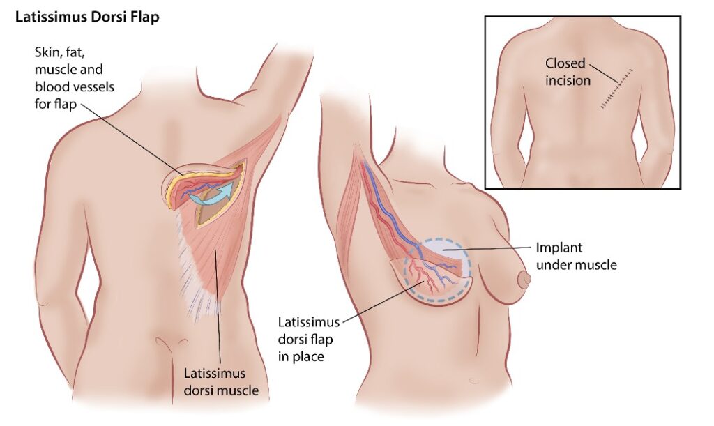 Plastic Surgery And Reconstruction
